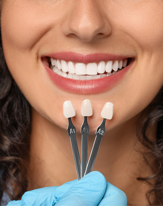 Woman having teeth shade matched for veneers