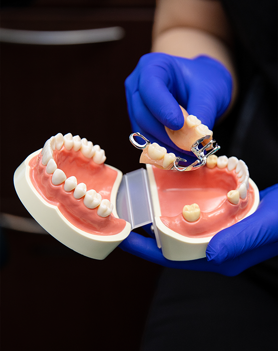 Gloved hand taking partial dentures out of a case