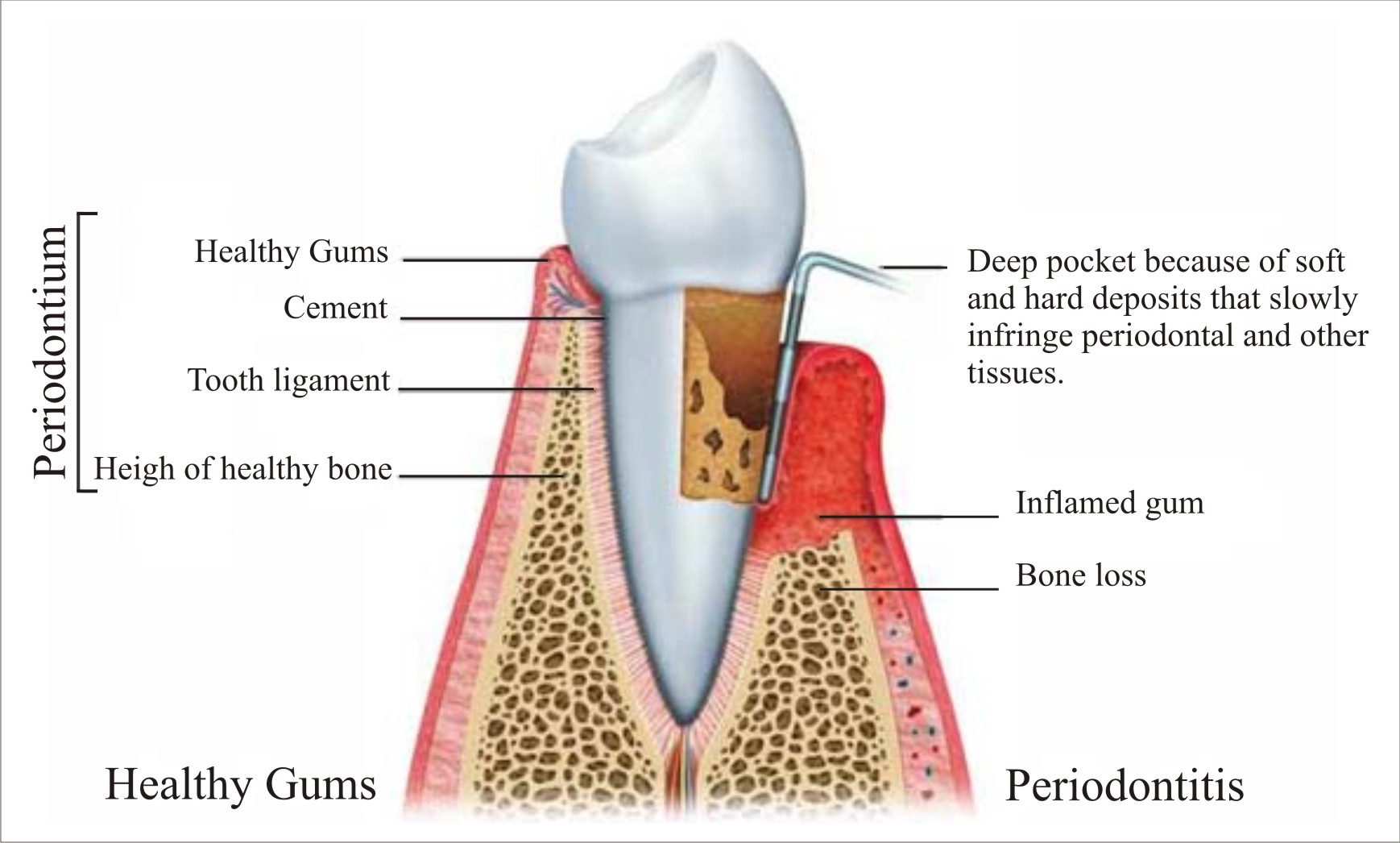 Oral Health