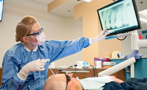 root canal