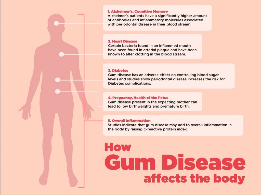 gum disease